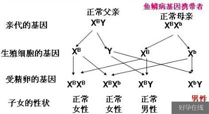 鱼鳞病遗传规律