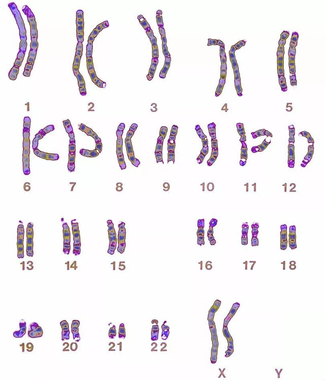 23对染色体