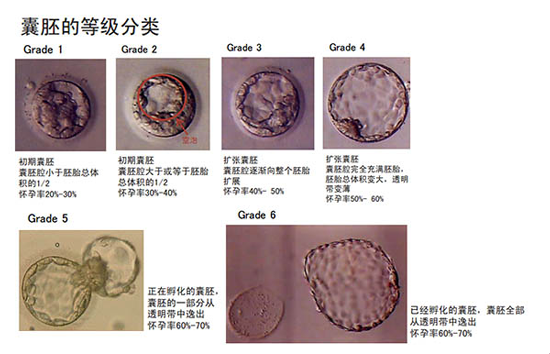 Gardner囊胚等级评分系统